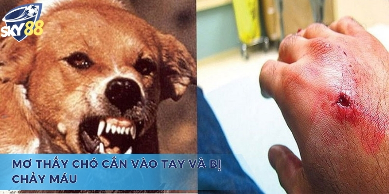 Mơ chó cắn vào tay đánh con gì, bị chảy máu là tốt hay xấu
